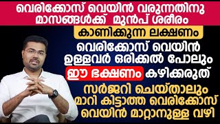 വെരിക്കോസ് വെയിൻ ഉള്ളവർ ഒരിക്കൽ പോലും ഈ ഭക്ഷണം കഴിക്കരുത്  Varicose veins Malayalam [upl. by Boyse]