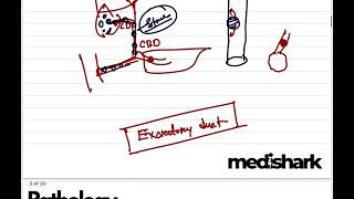 General Pathology Class 6 Metaplasia Dr Murtoza Shahriar [upl. by Rad]