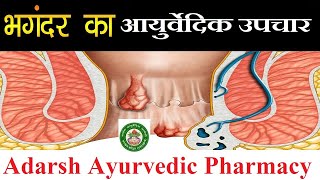 Fistula भगंदर को आयुर्वेदिक उपचार से करें दूर Treatment in Ayurveda EP127 part2 [upl. by Anneiv]