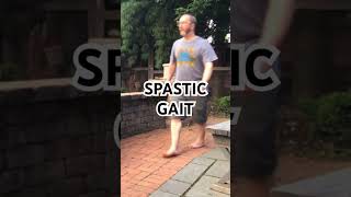 Spastic Gait [upl. by Lauter]