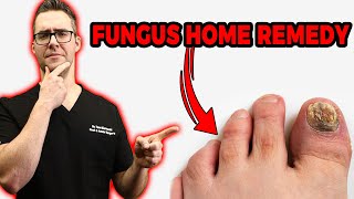 20 Ways To Get Rid of Toenail Fungus Proven CURE amp Home Remedies [upl. by Adigun]