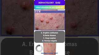 Cutaneous Signs and Diagnosis Quiz  Part 1 medicalmcqs dermatologyquiz [upl. by Marelda]