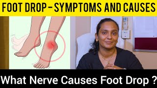 Foot Drop  पैर गिरना in Hindi लकवे के बाद पंजा नही उठने का ट्रीटमेंट  How to treat Foot Drop [upl. by Nrehtak635]