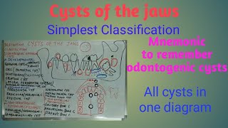 Cysts of the jaws  definition classification origin and location [upl. by Mayrim263]