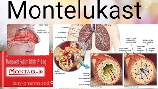 Montelukast Drug for Allergic Rhinitis [upl. by Nnylharas]