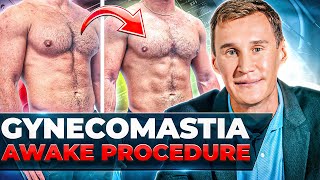 How To Fix GYNECOMASTIA in one AWAKE procedure [upl. by Yecats]