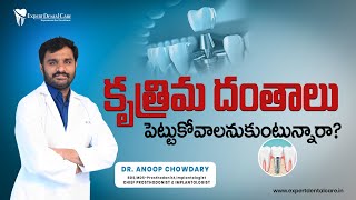 Dental Implants Explained by Dr Anoop  Expert Dental Care  Best Dental Hospital in Hyderabad [upl. by Nauqes919]