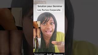 Solution pour Gommer les Taches noires au niveau du corps [upl. by Scandura]