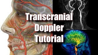 Transcranial Doppler Tecnique Anatomy amp Protocol [upl. by Shig]