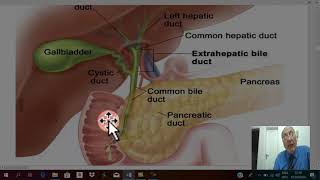 Billiary surgery 5  chronic cholecystitis 2  complications amp C P   by Dr Wahdan [upl. by Salman190]