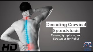 Cervical Spondylosis 101 Causes Symptoms and Treatment Insights [upl. by Sanfo]