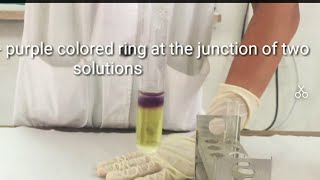 Rotheras test  for detection of ketone bodies in urine [upl. by Annwahsal571]