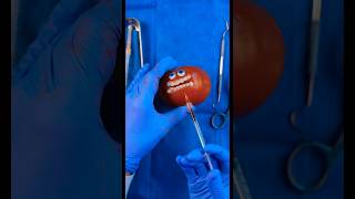 Emergency FruitSurgery Moldy Tomato gets attacked in FoodSurgery DiscountDentist Satisfying [upl. by Eylhsa]