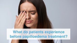 What do patients experience before papilloedema treatment [upl. by Enneira126]