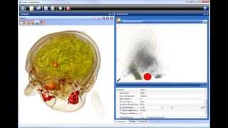 Volume Visualization based on Statistical TransferFunction Spaces [upl. by Llehsim]