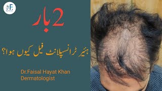 Why Hair Transplant Failed For Two Times Reasons DrFaisal Hayat Khan •Dermatologist•FAesthetics [upl. by Ativel]