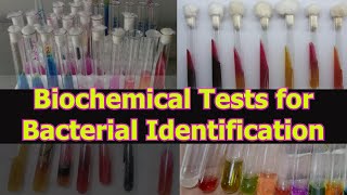 BIOCHEMICAL TESTS FOR BACTERIAL IDENTIFICATION [upl. by Dutch]