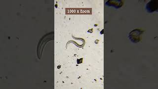 LOOK what I found in Soil🤯CloseUp of Nematodes under the Microscope shorts nematode microbiology [upl. by Macintosh]