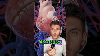 Sindrome del CUORE INFRANTO o di TAKOTSUBO cuore infarto stress adrenalina [upl. by Tobias]