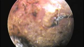 DES MOINES VETERINARY CARE VIDEO  Ear Mites Viewed with Video Otoscope at Ingersoll Animal Hospital [upl. by Shani]