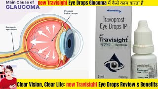 NEW TRAVISIGHT Eye Drop Review amp Glaucoma Management thepharmacistdrx travisighteyedroops [upl. by Ybab]