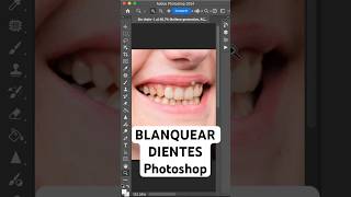 Blanquear dientes con Photoshop [upl. by Esiocnarf]