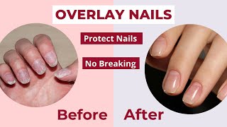 Overlay Nails  What are they amp Benefits [upl. by Cogen]