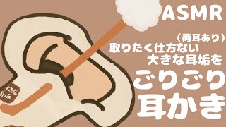 【ASMR】取りたくて仕方ない大きな耳垢をごりごり耳かき（両耳あり） Ear Cleaning 【No Talking】 [upl. by Enytnoel618]