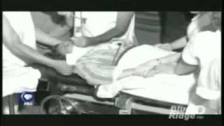 Lobotomy  PBS documentary on Walter Freemanmp4 [upl. by Yarezed]