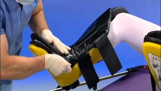 Allen Medical  Allen Stirrups  Instructional Video [upl. by Akemehs]