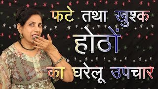 Home remedies for chapped Lips  Beauty Videos in Hindi  Beauty Channel  Beauty Blogger Skin Care [upl. by Helbonia42]