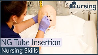 NG Nasogastric Tube Insertion Techniques Nursing Skills [upl. by Sugna]