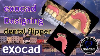 ExoCad dental flipper design [upl. by Sonny856]