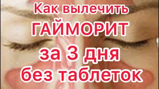 Как вылечить гайморит в домашних условиях ПРОВЕРЕНО НА СЕБЕ [upl. by Tranquada]