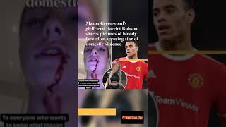 Mason Greenwood’s girlfriend shares pictures of bloody face after accusing star of domestic violence [upl. by Ronym]