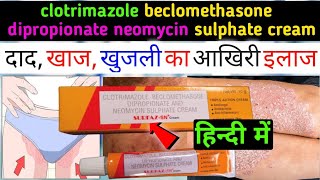 clotrimazole beclomethasone dipropionate neomycin sulphate cream uses in hindi  surfaz sn cream [upl. by Nirac]