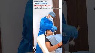 chemical peel procedure in detail by Dr Sandeep Gupta The Dermatologist skincare lasertreatment [upl. by Agna502]