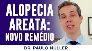 Baricitinibe Novo Tratamento Para Alopecia Areata – Dr Paulo Müller Dermatologista [upl. by Nived616]