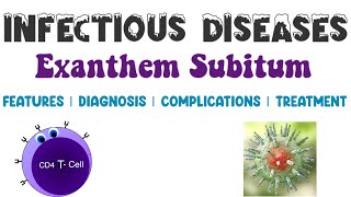 Exanthem Subitum  Viral Infections  Infectious Diseases 4  Medicine [upl. by Zamora]