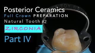 Zirconia Ceramics Part 4 AllCeramic Crown Preparation 2 Natural Tooth [upl. by Eremahs]