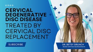 Case study 72  Surgeon explains cervical degenerative disc disease treated by disc replacement [upl. by Enirolf]