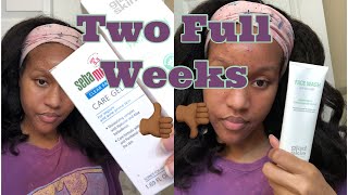 I tried Gladskin Gel to Milk Cleanser and Sebamed Clear Face Care Gel on my Acne  Full review [upl. by Arabel]