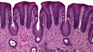 Circumvallate papillae  practical Histology [upl. by Llenil407]