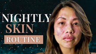 The Ultimate Skincare Routine for Birthmarks [upl. by Lirret]