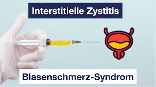 Interstitielle Zystitis  Diagnose Symptome Therapie Blasenschmerzsyndrom [upl. by Perry]