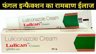 lulican cream Uses  Luliconazole Cream 1 ww uses in Hindi Fungal infection treatment [upl. by Micheal379]