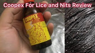 How to remove Head Lice and Nits in One day Coopex Anti Lice Lotion Review does it work or not [upl. by Bodrogi]