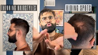 How to style SHORT THINNING Hair  Mens Hair Loss [upl. by Nosyrb]