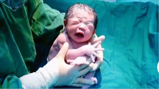 Newborn Baby first Cry of life after Birth  Newborn babies Journeys [upl. by Baptiste]