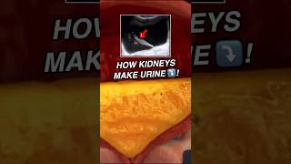 Doctor explains URETERAL JET 💛🛩️💦 sciencefacts [upl. by Nur]